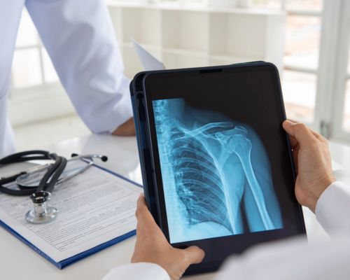 Digital X-Ray